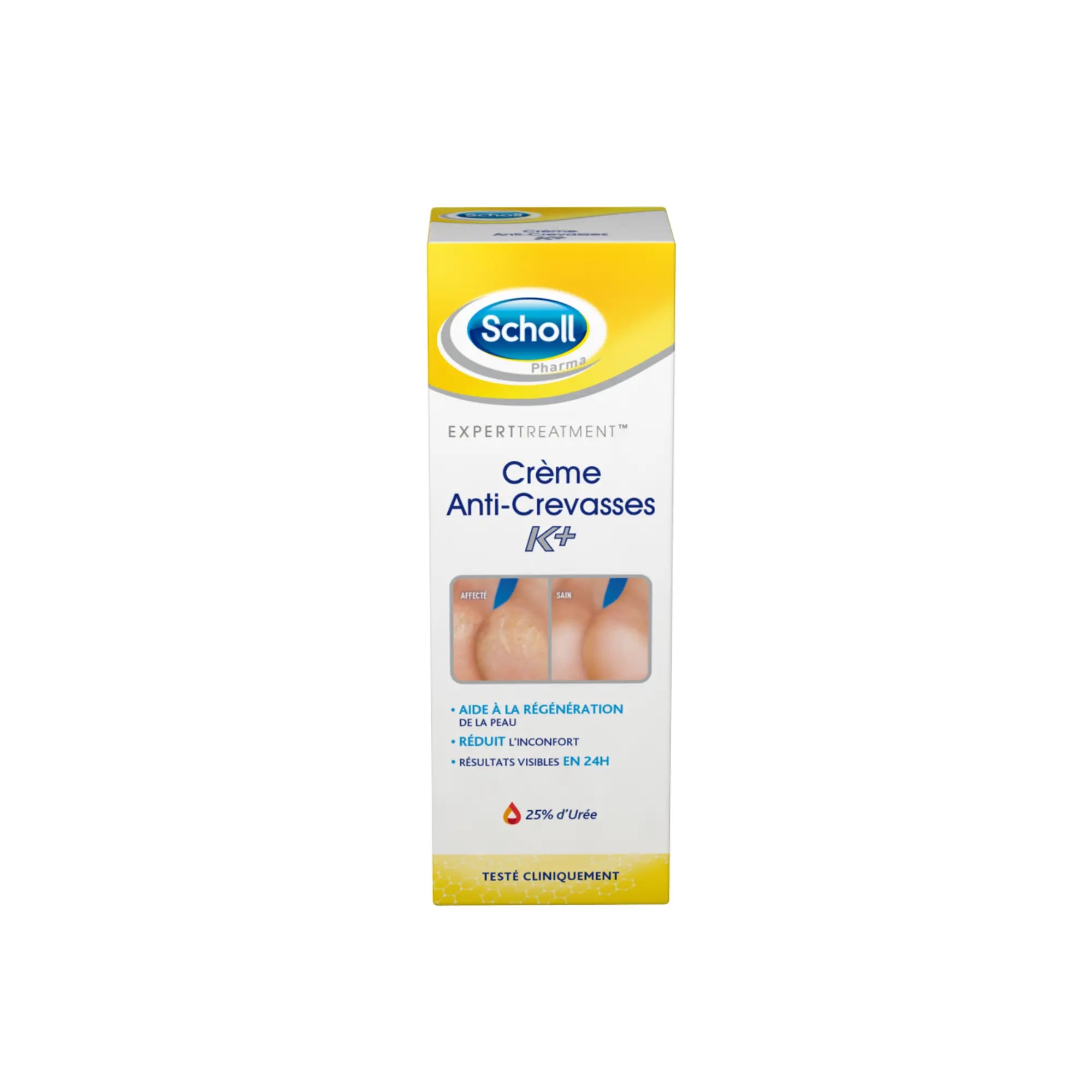 Crème Anti-Crevasses K+ Urée 25% - 2 contenances - Scholl
