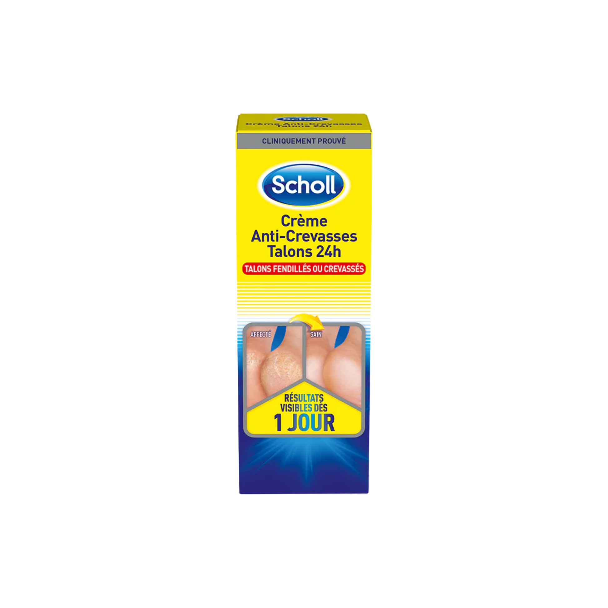 Crème Anti-Crevasses K+ Urée 25% - 2 contenances - Scholl - My Médical
