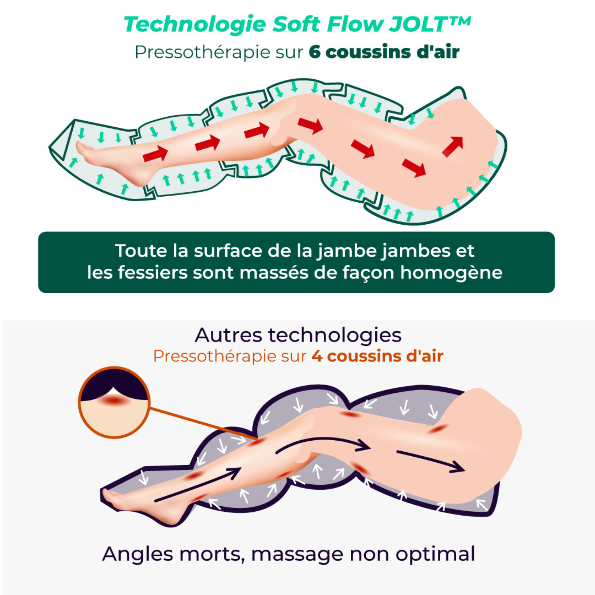 Pressotherapy Pants - Complete Pack - 2 Sizes - Jolt Pants