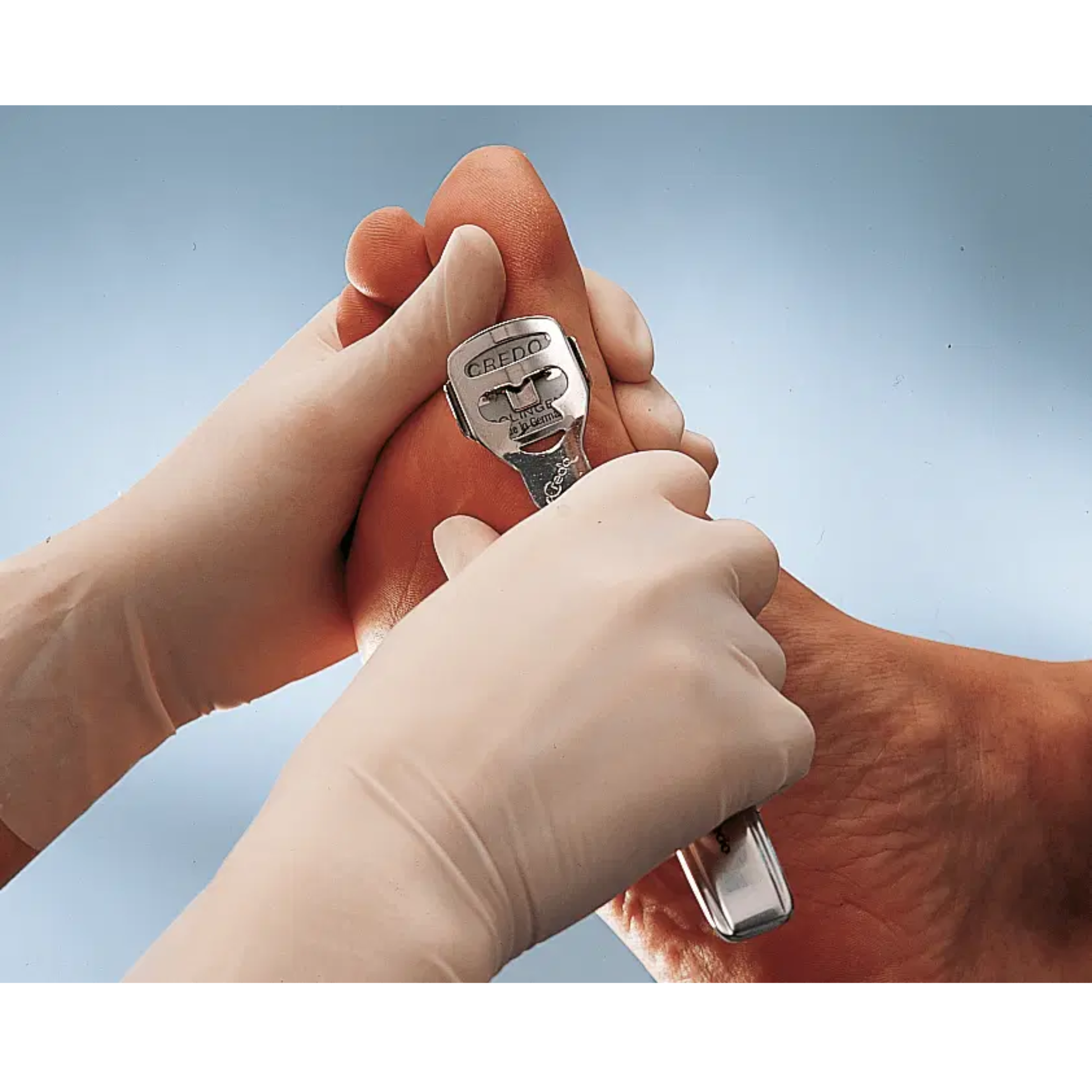 Rabot à callosités en Inox avec adaptateur râpe - 14,5 cm - Credo - My Médical